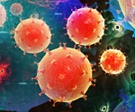 Rising antibiotic resistance threatens UTI treatment in Malawi