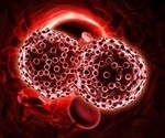 High cost of immunotherapy linked to financial hardship among cancer survivors