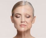 New biological age clock estimates how well someone is aging