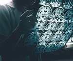Inflammation and Alzheimer's Disease