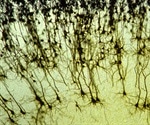 Memory neurons in rats may explain why forgetting meals leads to overeating