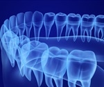 Micro-CT of Dental Samples for Forensic Analysis