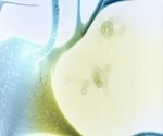 Unlocking critical insights into Alzheimer’s disease pathology