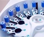 Improved SARS-CoV-2 surveillance testing with self-collected saliva