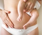 New perspectives on C-section and microbiota in newborns
