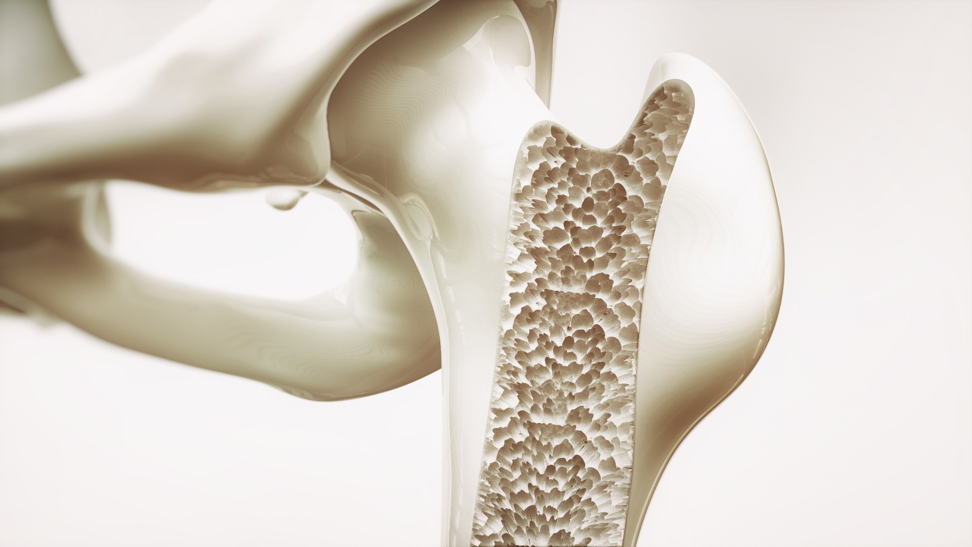 Review: The Impact of Fermented Dairy Products and Probiotics on Bone Health Improvement. Image Credit: Crevis / Shutterstock