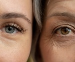 Can your diet slow skin aging? New review reveals what helps and what harms