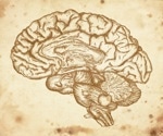 MRI scans reveal why young women face higher risk for eating disorders
